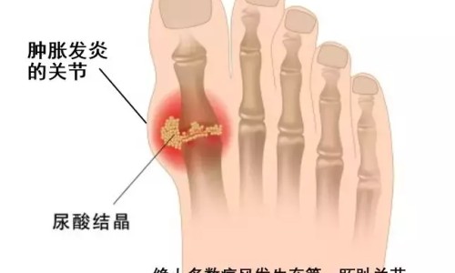 面霜是越贵越好吗-【买面霜该买贵的还是一般的】面霜买贵的有用吗 - 面霜贵的便宜的没区别网